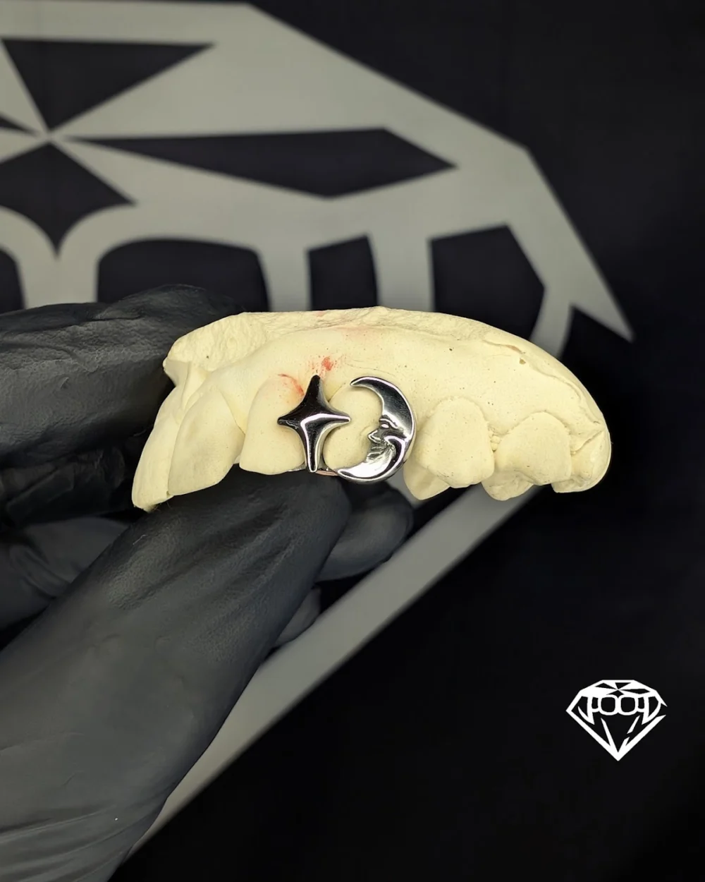 Grillz Granada